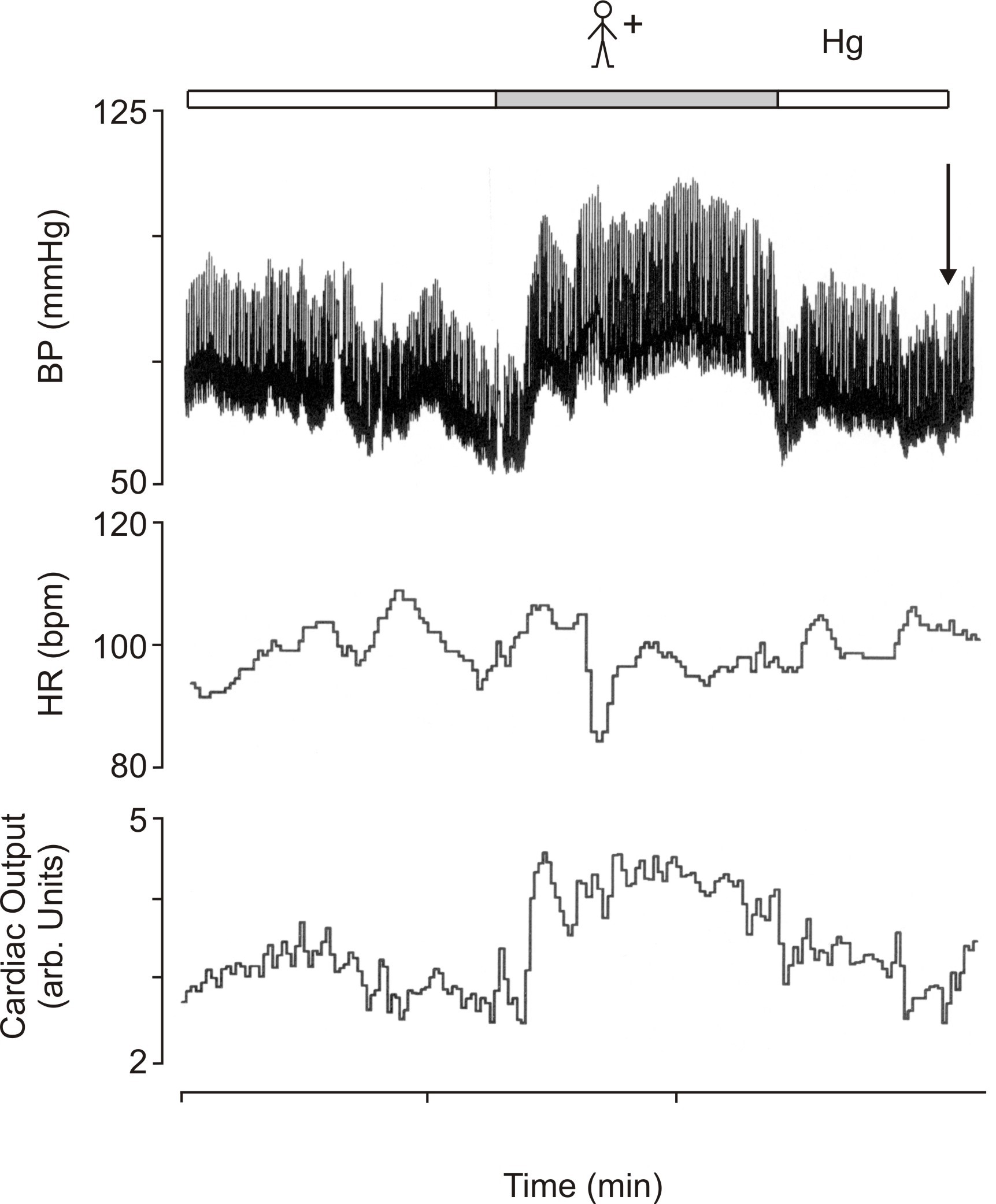 increasing blood pressure using muscle tensing for vasovagal syncope