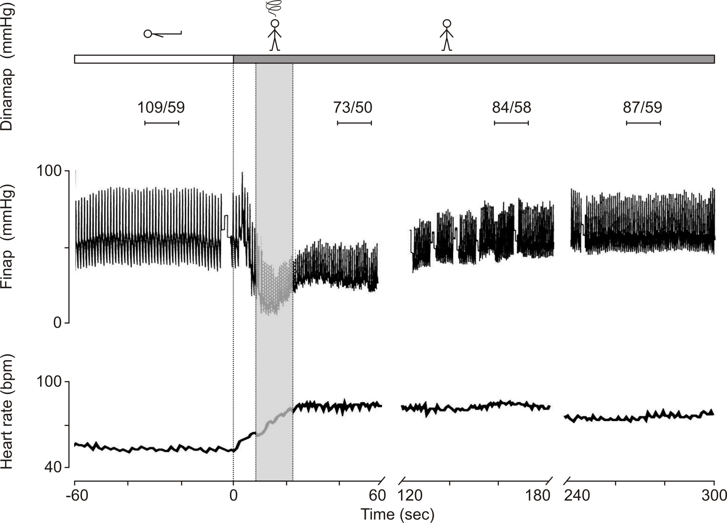 initial orthostatic hypotension
