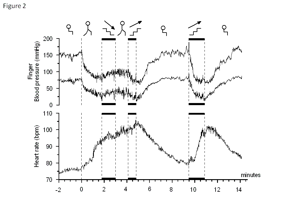 walking stairs in pure autonomic failure