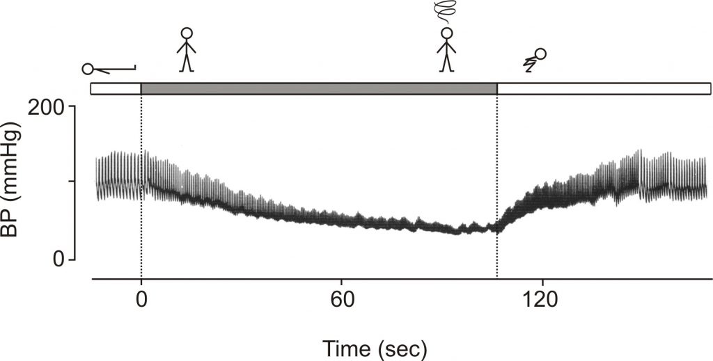blood pressure squatting autonomic failure