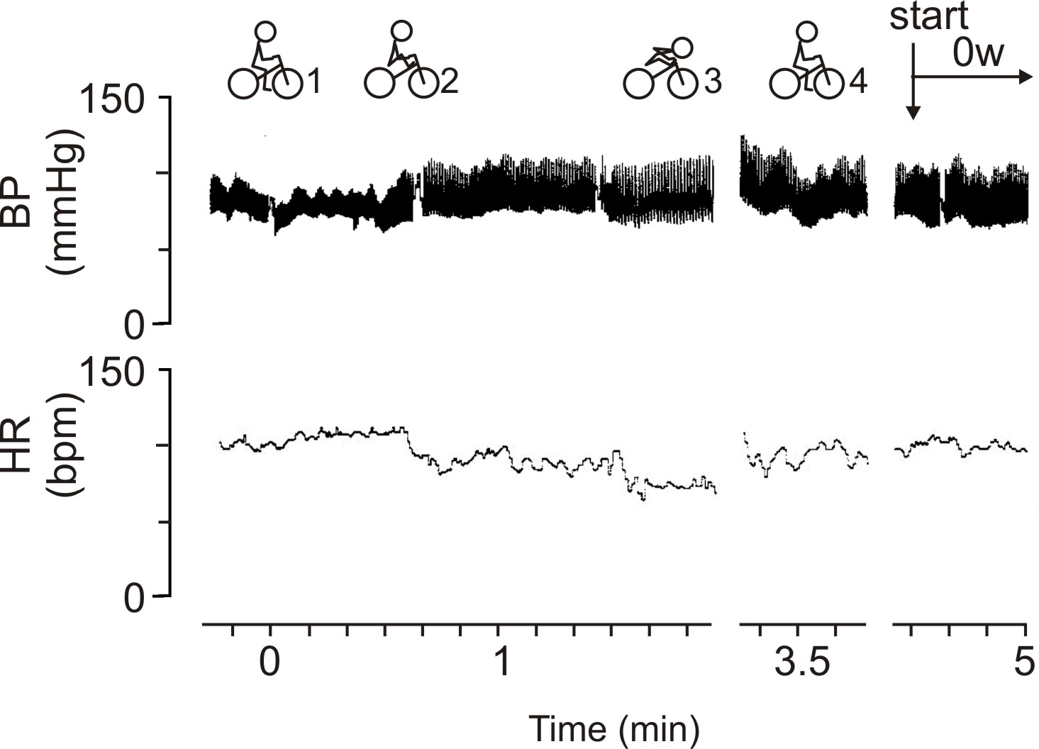 blood pressure while cycling with autonomic failure