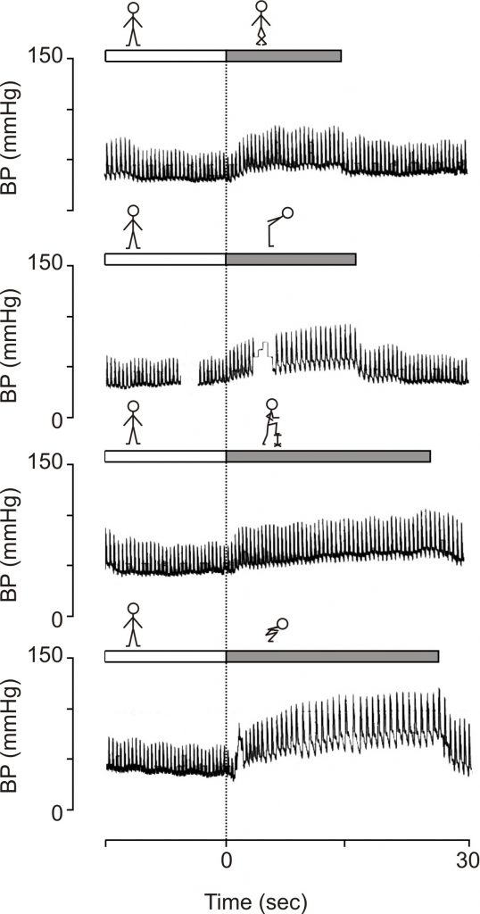 blood pressure physical manoeuvres autonomic failure