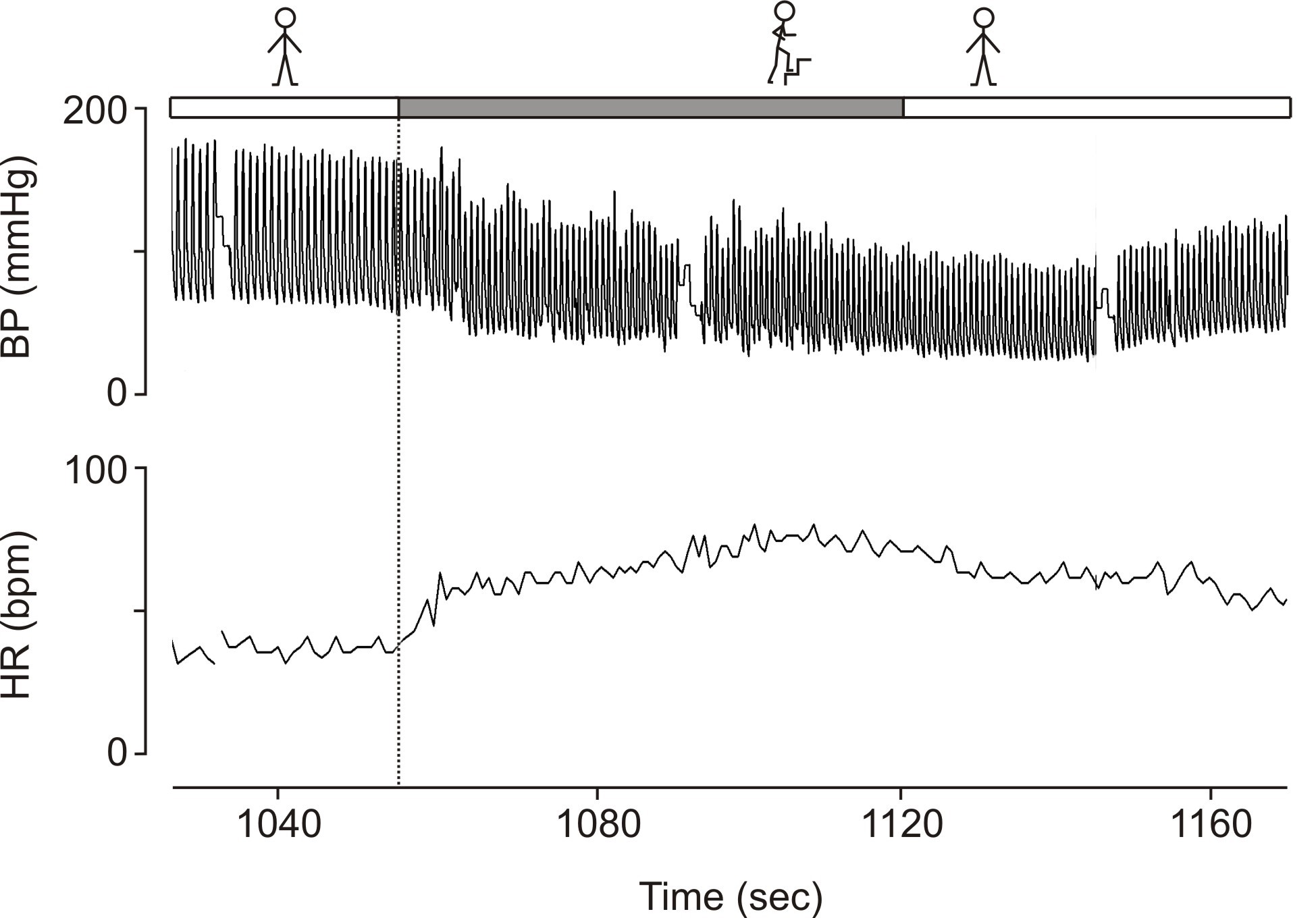 legionella transient loss of consciousness