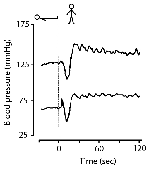 initial orthostatic hypotension